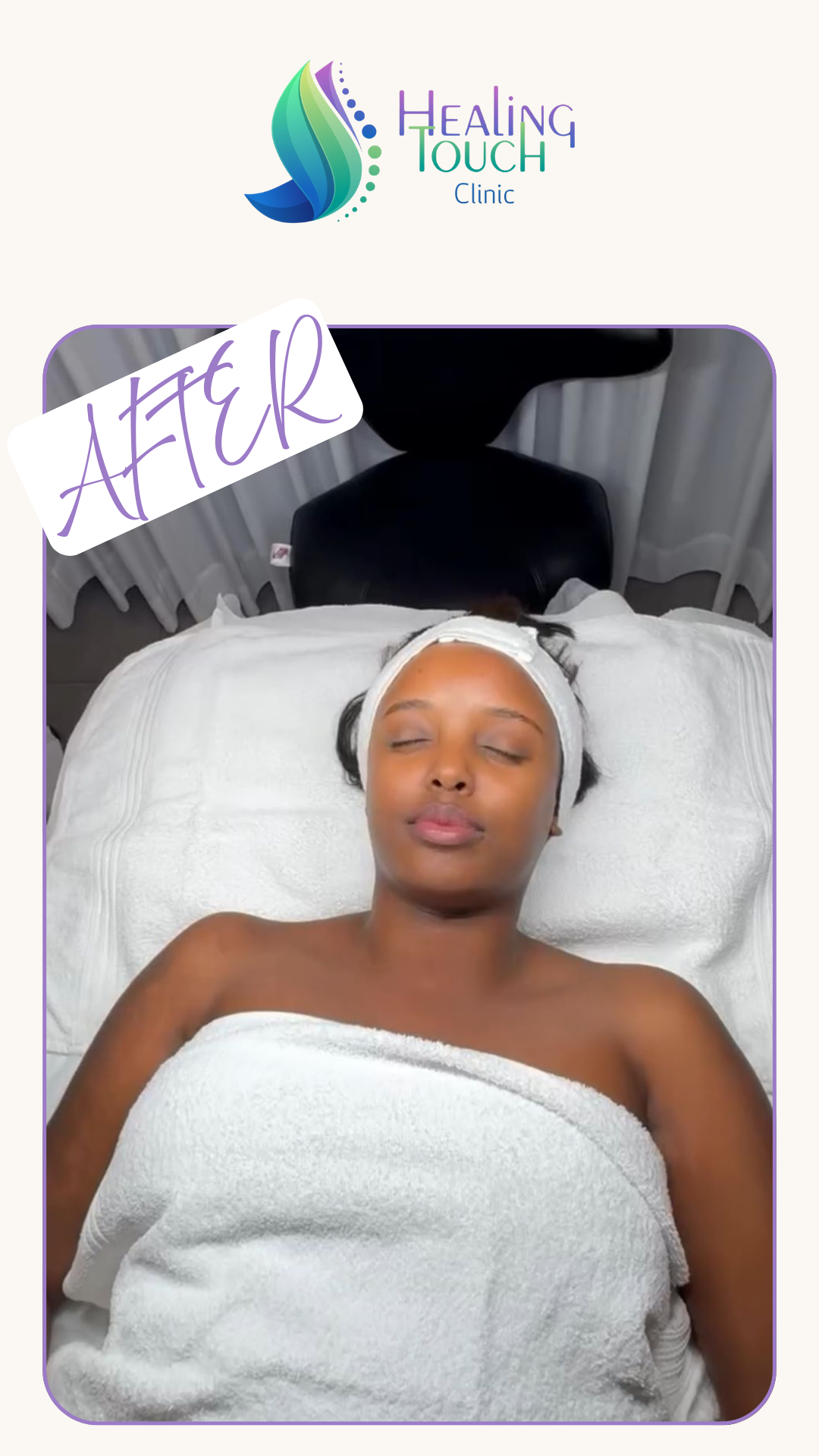 _טמפלט אחרי אלירן קרסו HT CLINIC